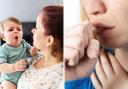 Whooping cough (pertussis), also known as the 100-day cough, is a bacterial infection of the lungs and breathing tubes, according to the National Health Service ( NHS).